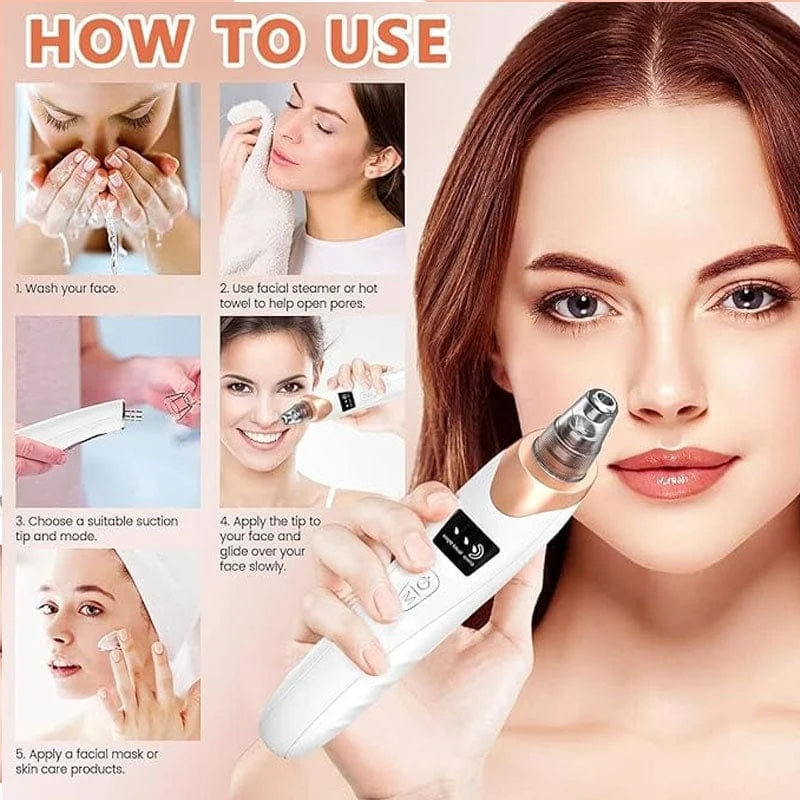 5-in-1 Rechargeable Blackhead Remover - with 5 Interchangeable Heads
